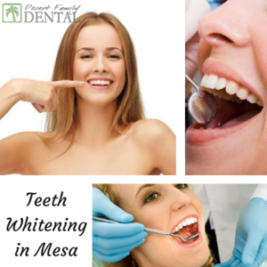 trusted dental clinic in Mesa
